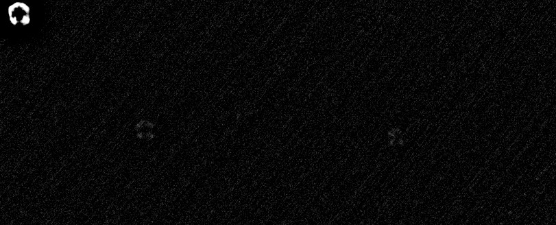 The full-depth centre of the same stack, close up. The brightest star carries the annulus of a defocused Newtonian; the faint diagonal weave is correlated noise, not sky.
